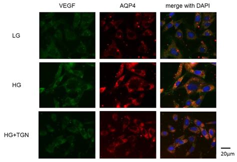 Effects of an Aquaporin 4 Inhibitor, TGN-020, on Murine Diabetic Retina