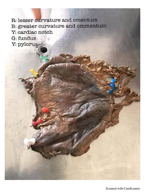Anatomy of Git System in Amharic 的图像结果