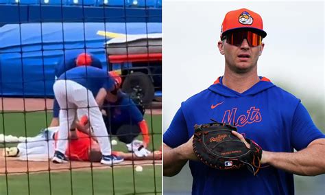 Mets' Pete Alonso suffers gruesome injury after getting hit in face ...