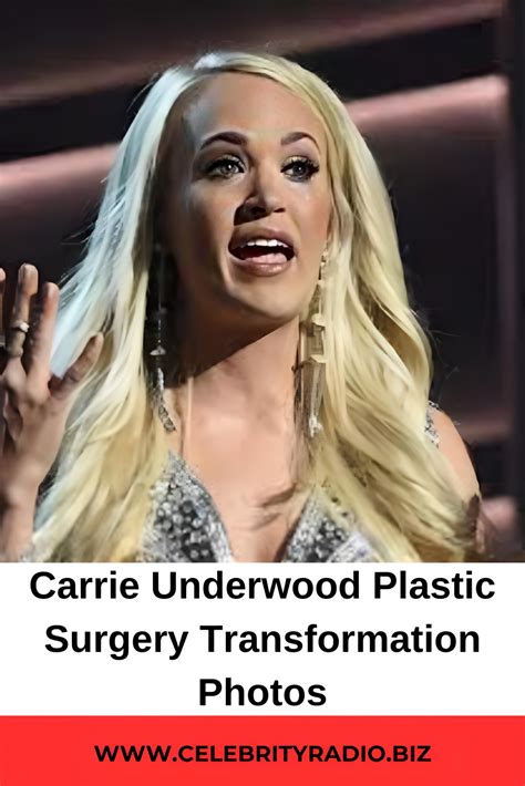 Carrie underwood plastic surgery before and after photos – Artofit