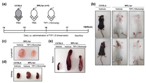 Toll-like Receptor Signaling Inhibitory Peptide Improves Inflammation ...