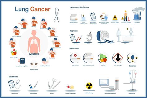 médico infografía ilustración concepto de pulmón cáncer, síntomas, causas y riesgo factores ...