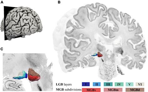 Medial Geniculate Nucleus Coronal
