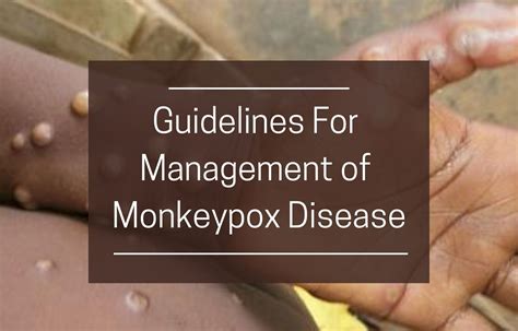 Attention Doctors: Check out the Ministry of Health Guidelines on ...