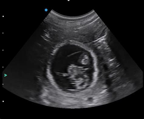Pregnant Dog Ultrasound