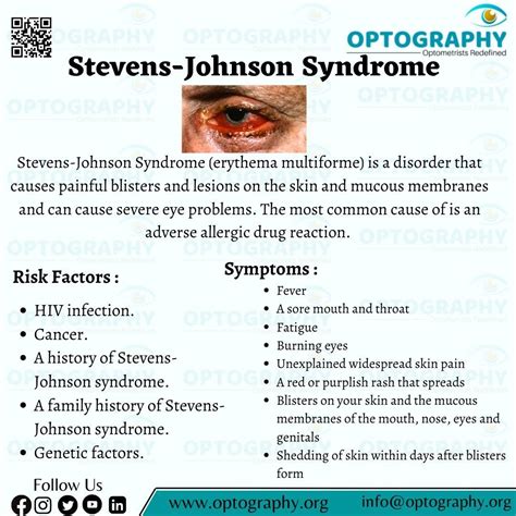 Steven Johnson syndrome | Steven johnson syndrome, Steven johnson, Medical knowledge