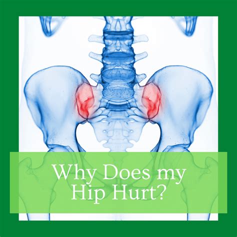 Why Does my Hip Hurt? | Alternative Health Center of The Woodlands