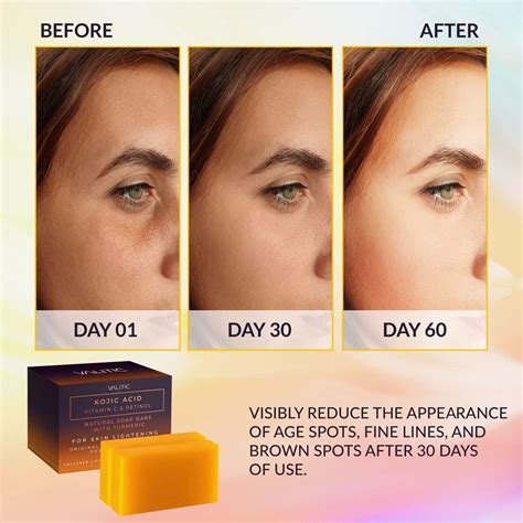 Valitic Kojic Acid Vitamin C and Retinol Soap Bars with Turmeric - Skin ...