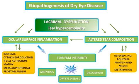 Analysis of the Pathogenic Factors and Management of Dry Eye in Ocular ...