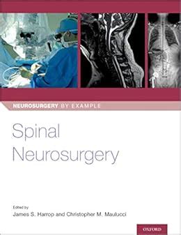 Spinal Neurosurgery (Neurosurgery by Example Book 3) eBook : Harrop ...