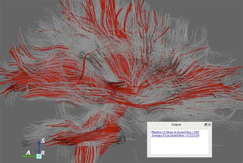Image result for Interactive QueryInterface