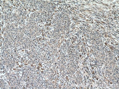 Amphiregulin antibody (66433-1-PBS) | Proteintech