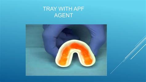 Image result for Fluoro APF