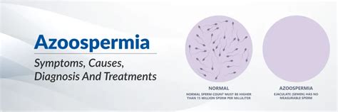 Azoospermia (recuento cero de espermatozoides): causas, síntomas y ...