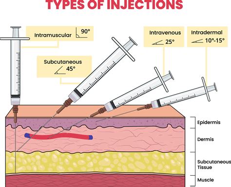 Image result for All Types of Injection