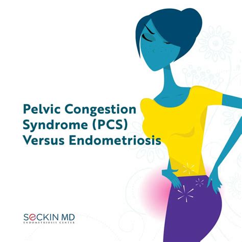 Pelvic Congestion Syndrome (PCS) Versus Endometriosis