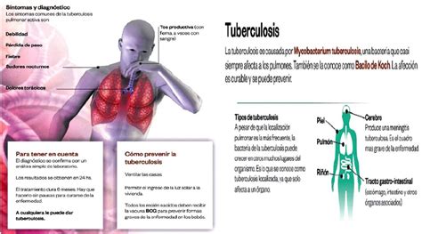 Tuberculosis Estadisticas