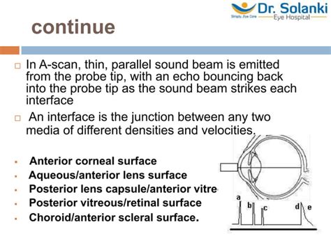 Image result for What Is an a Scan Biometry