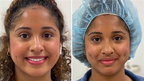 Image result for Small Dimples