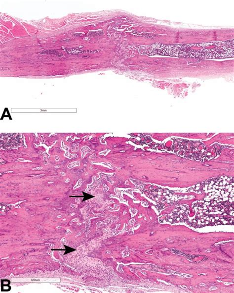 Modelling 1st Radius 的图像结果