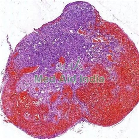 Prepared Microscope SLIDE Virtual Oral Pathology Manufacturer ...