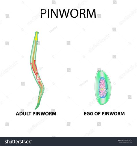 Pinworms