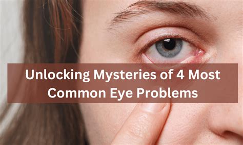 Image result for Common Eye Problems