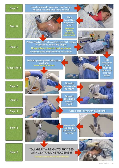 Arterial line – Artofit