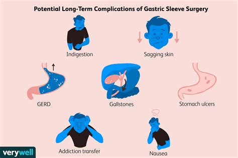 Long-Term Complications After Gastric Sleeve Surgery