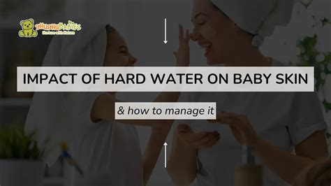 Understanding the impact of hard water on baby skin and how to manage ...