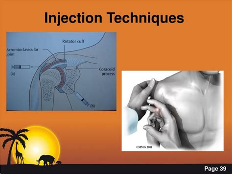 PPT - The Shoulder in General Practice PowerPoint Presentation, free ...