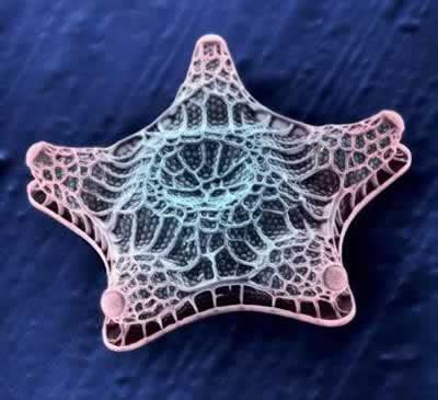 Diatom (Bacillariophyceae)