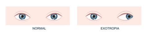 Image result for Alienware Laptop Monitor