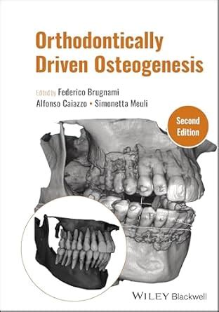 Buy Orthodontically Driven Osteogenesis Book Online at Low Prices in ...