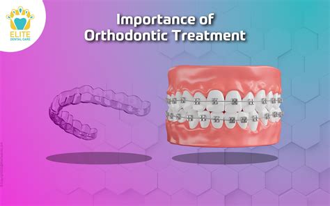 Orthodontic Treatment Sequence at Erin Wright blog