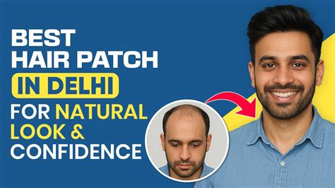 Best Hair Patch in Delhi for Natural Look & Confidence – Malhotra Hair ...