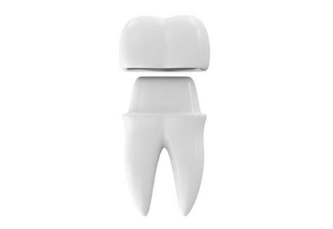 Dental Crown and Bridge | Dental Square | Best dentist and dental ...