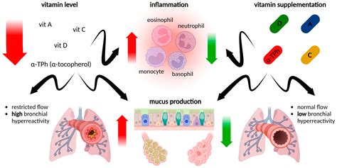 The Role of Vitamins in the Pathogenesis of Asthma