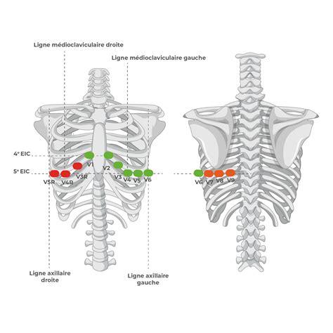 Electrodes Position In Ecg