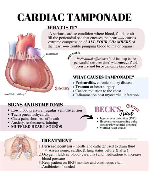 Cardiac tamponade. : r/FOAMed911