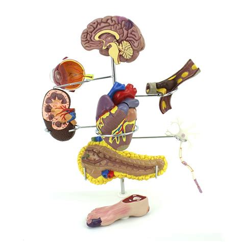 Anatomy Models Human Anatomy Science Models Diabetes Organ ...