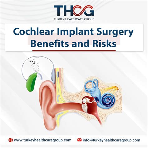Cochlear Implant Surgery Benefits and Risks 2024 - Turkey Health Care Group
