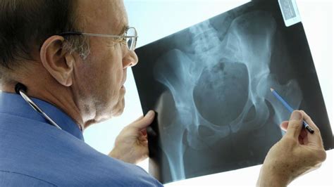 do you need a referral for an orthopedic doctor