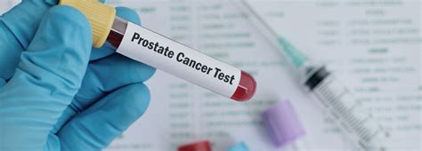 Image result for PSA