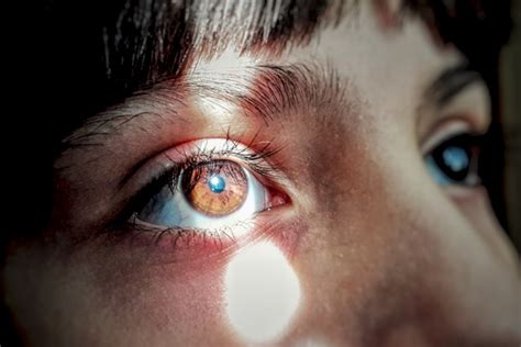 Image result for Eye Floater Types