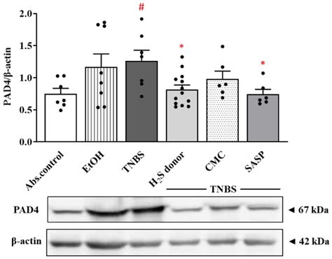 Investigation of H2S Donor Treatment on Neutrophil Extracellular Traps ...