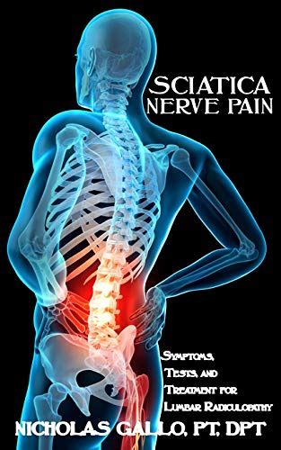 Buy Sciatica Nerve Pain: Symptoms, Tests, and Treatments for Lumbar ...
