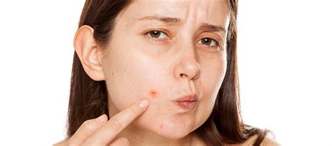 How To Prevent Skin Breakouts In Humid Weather? – Re'equil