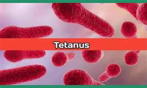 Diphtheria Pertussis Tetanus Meaning in Tamil-தசை விறைப்பு, தாடை ...