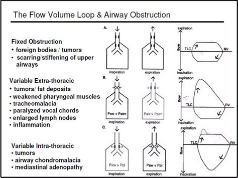 Pulmonary Flow Volume Loops.. Dr.Padmesh | PPTX